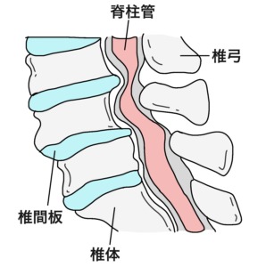 脊柱管狭窄症の構造
