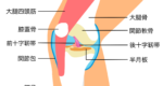 半月板損傷と診断