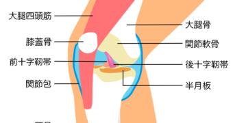 半月板損傷と診断