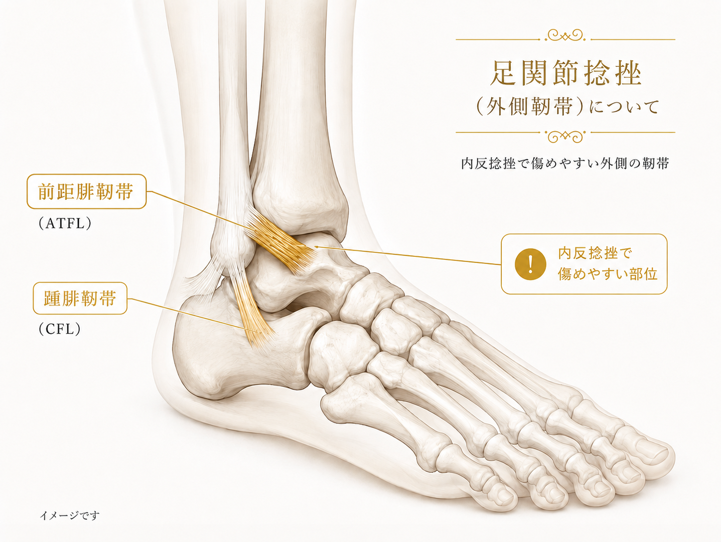 足関節外側の前距腓靭帯と踵腓靭帯の位置を示したイメージ図