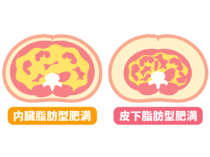 内臓脂肪と皮下脂肪