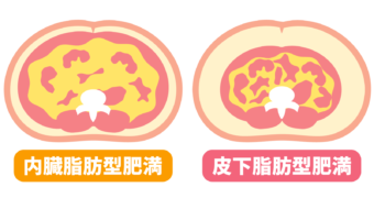 内臓脂肪と皮下脂肪